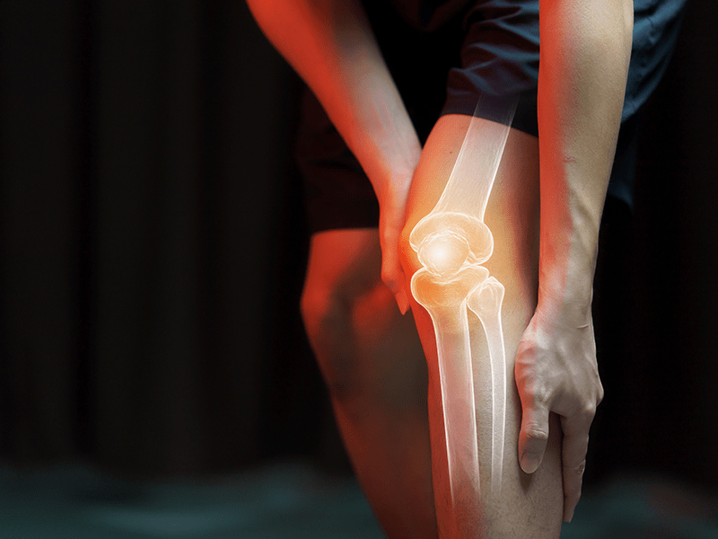Bilateral Knee Replacement Information